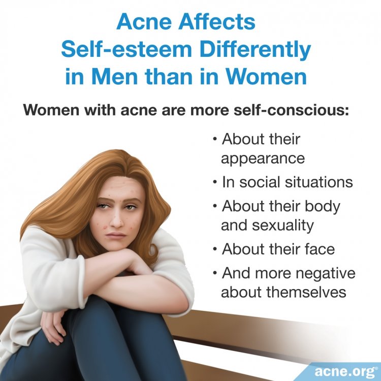 Acne Affects Self-esteem in Men Differently than in Women