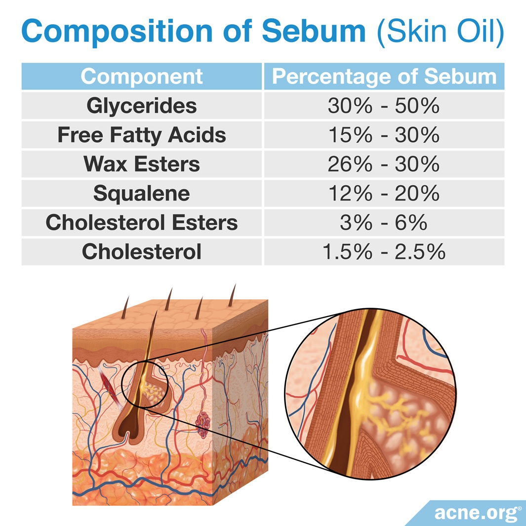 how-fatty-foods-affect-acne-acne