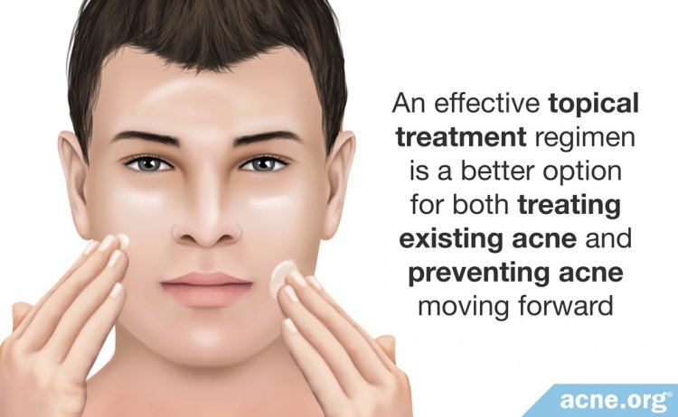Effective Topical Treatment Better Than Heat Therapy for Acne