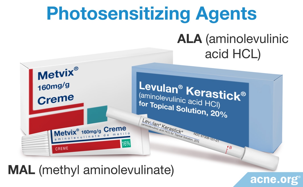 Does Photodynamic Therapy Work for Acne?  Acne.org