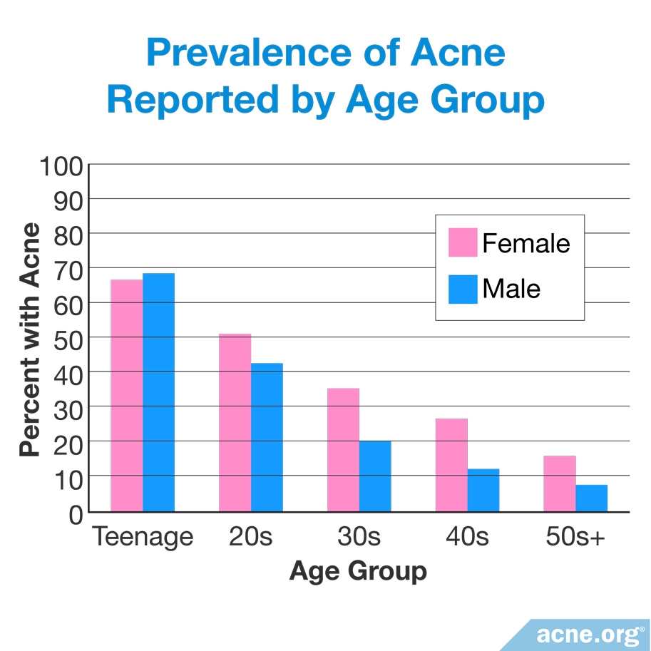 how-common-is-adult-acne-acne