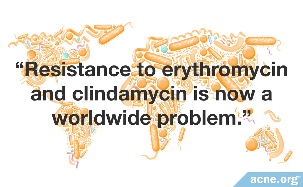 Antibiotic Resistance In Acne Treatment