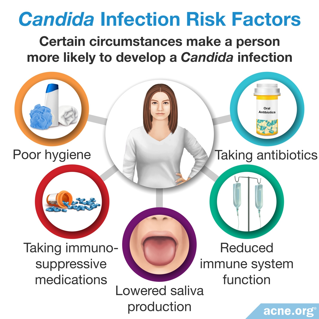 Can Candida Cause Acne 