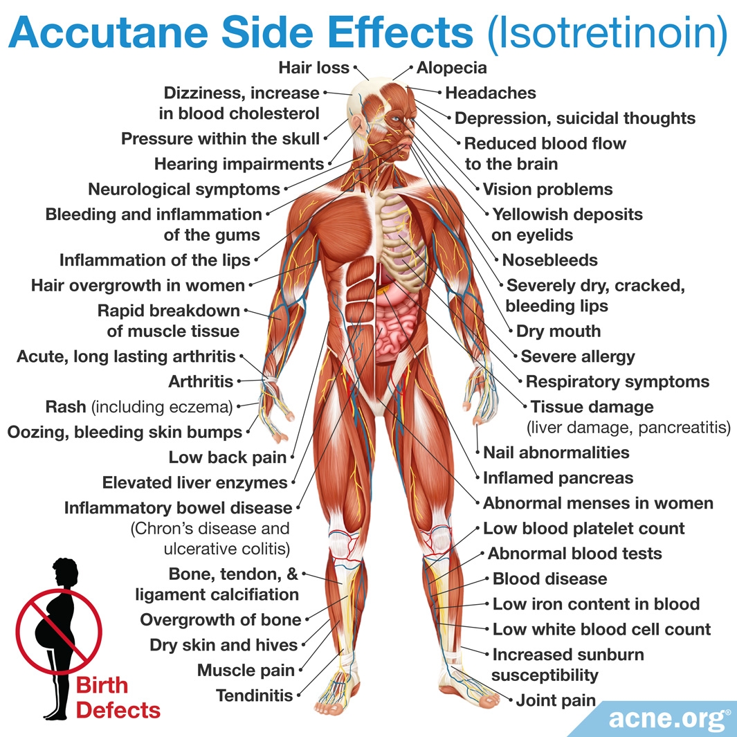 does-taking-oral-isotretinoin-cause-the-skin-to-age-faster-acne