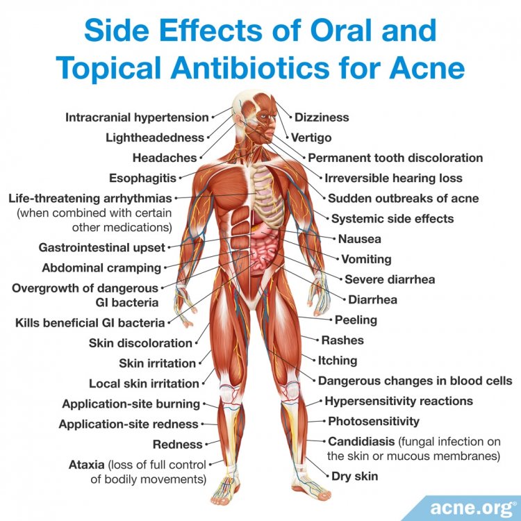 the-dangers-and-ineffectiveness-of-antibiotics-for-acne-acne