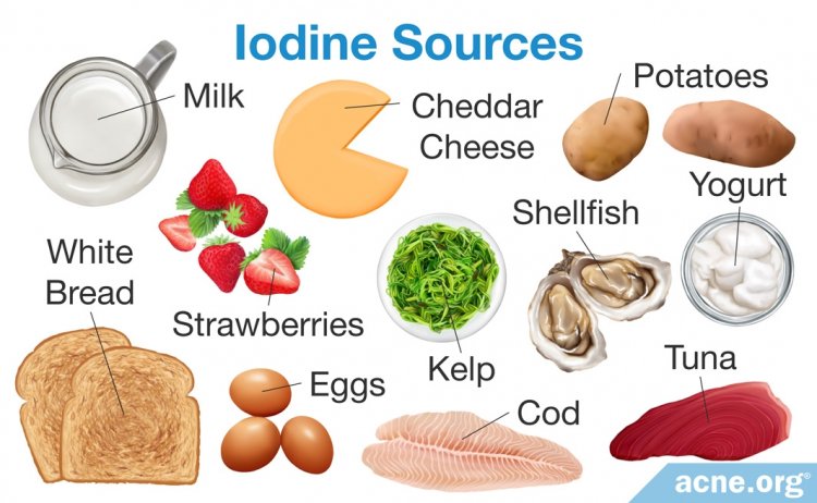 Sources of Iodine