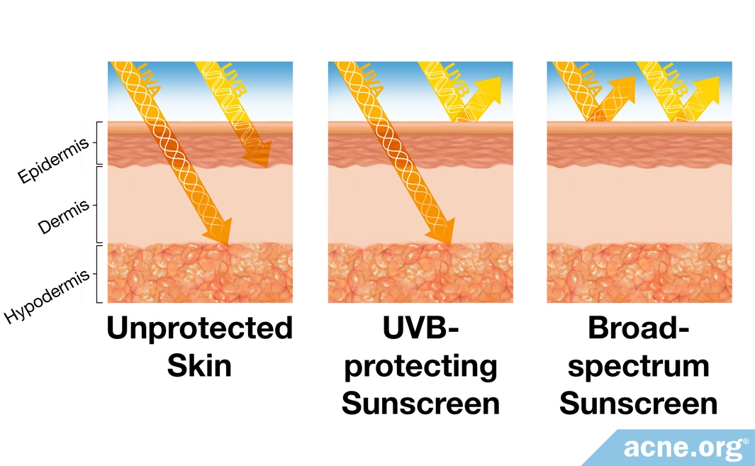 Unprotected Skin vs. Sunscreen-protected Skin