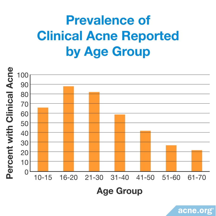 How Common Is Adult Acne