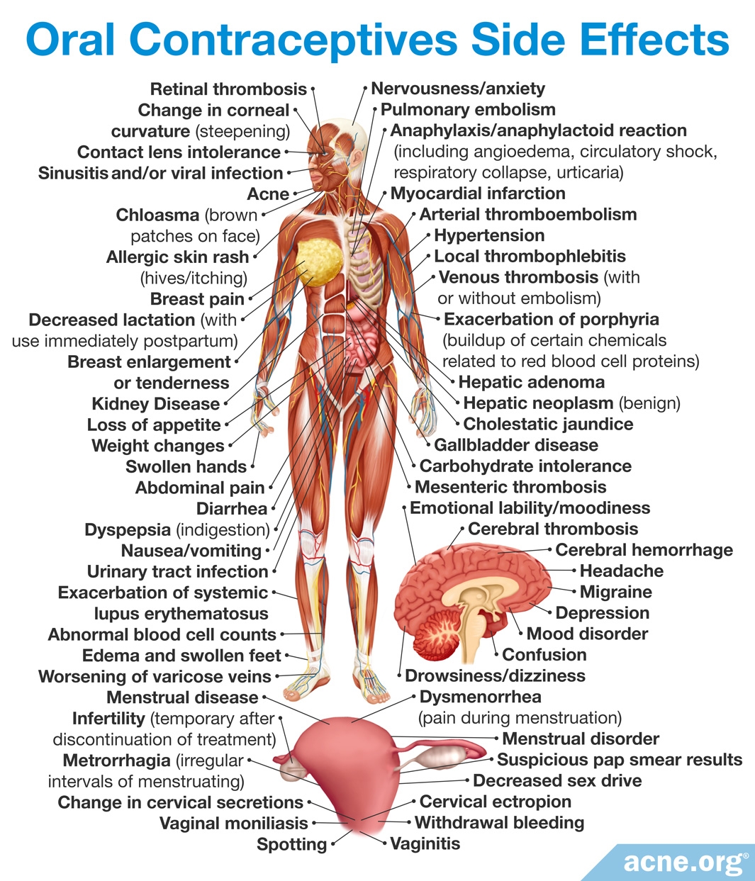 Side Effects of Oral Contraceptives