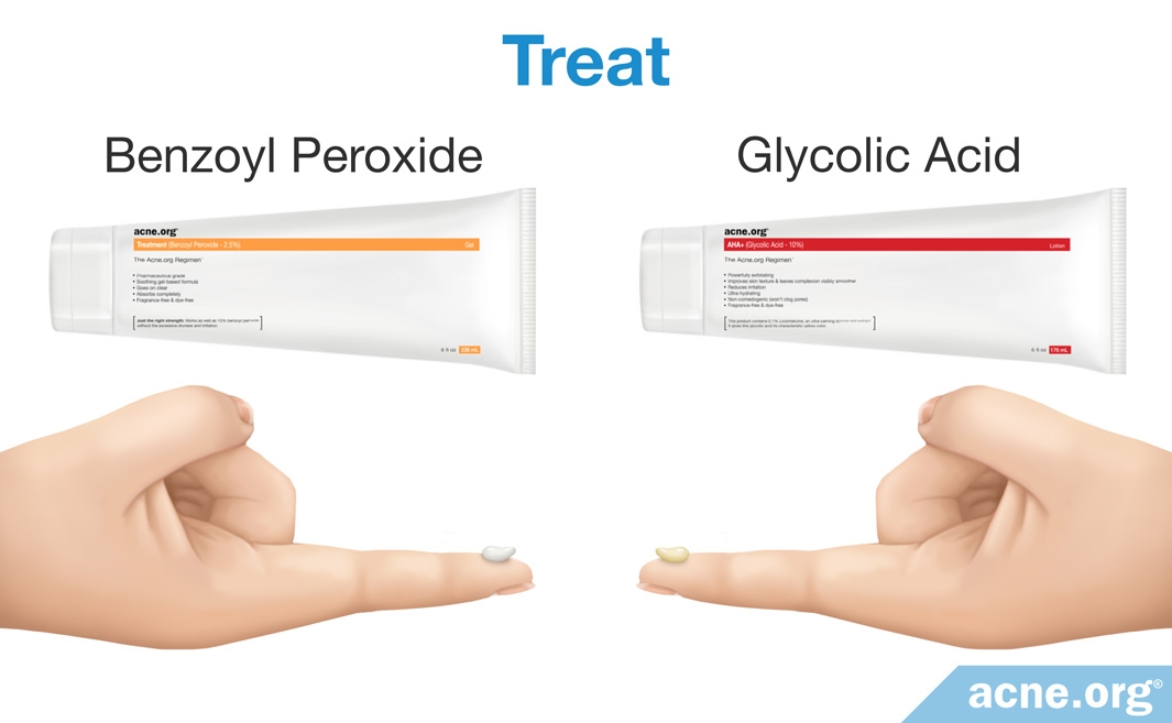 The ZIIT Method (Acne Spot Treatment) Zinc + Ibuprofen + Ice + Treat