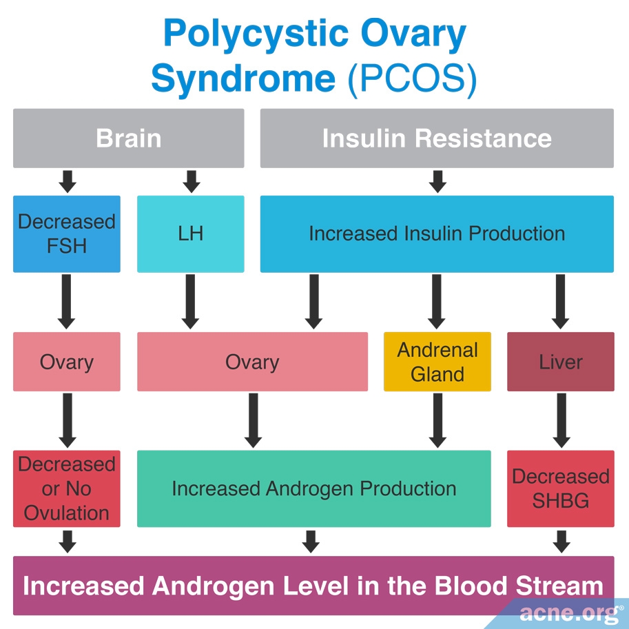 What Is Polycystic Ovary Syndrome Pcos And How Does It Affect Acne ...