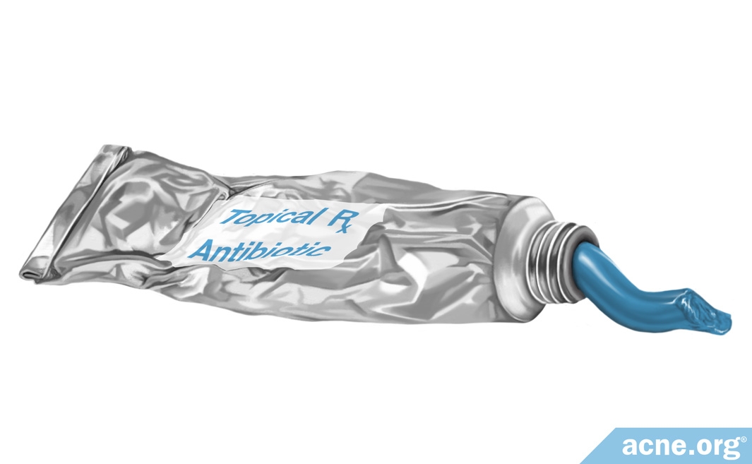 Are Antibiotics a Good Idea for the Treatment of Acne?