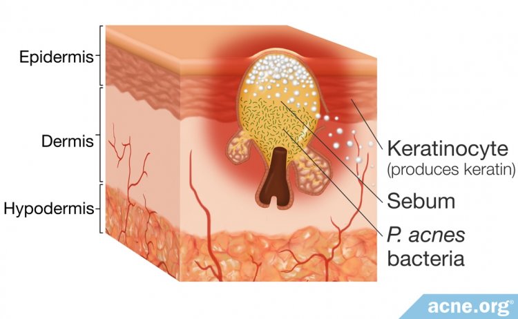 Sebum in the Skin