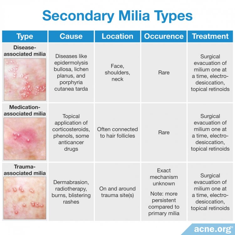 Secondary Milia Types