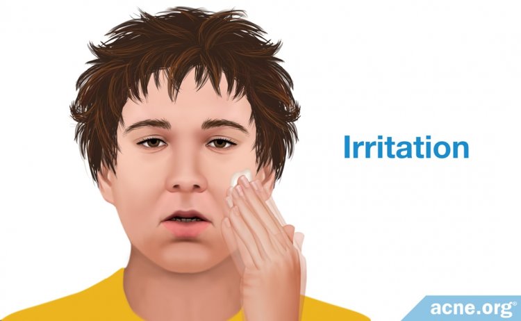 Irritation