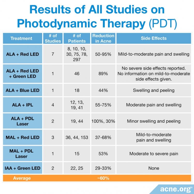 Does Photodynamic Therapy Work for Acne?  Acne.org