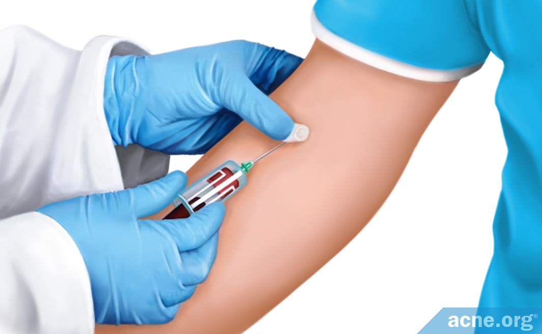 What Does A Zinc Blood Test Show