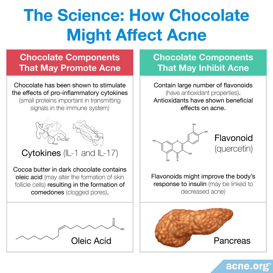 chocolate-and-acne-acne