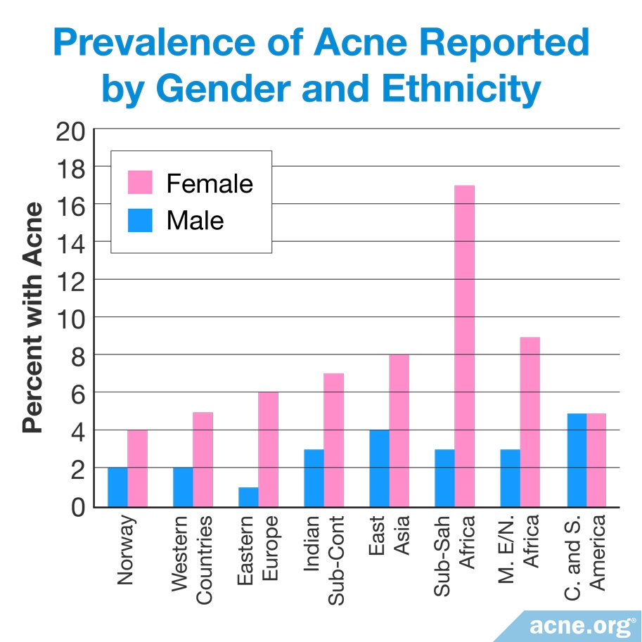 how-common-is-adult-acne-acne