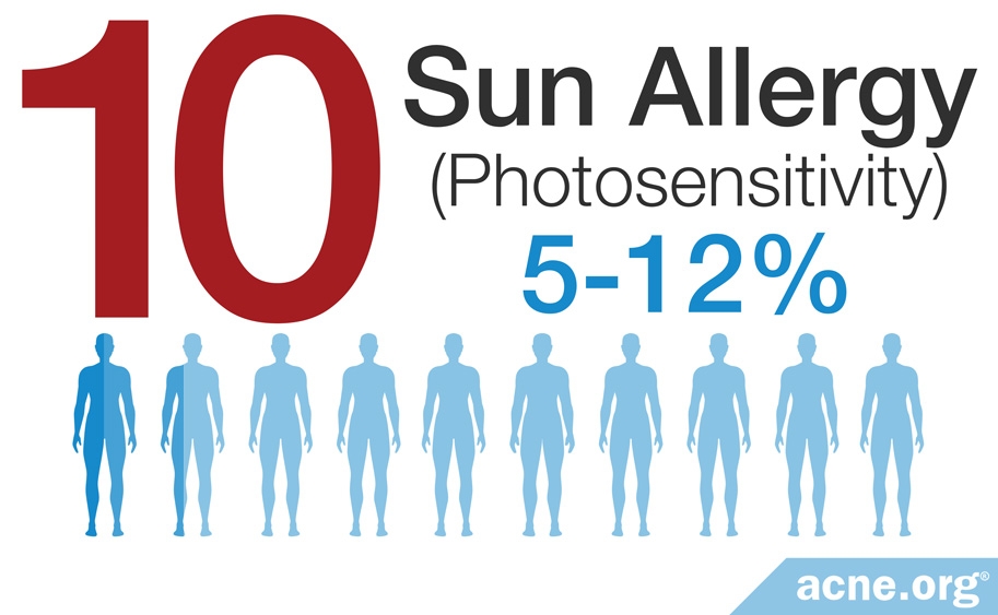 Photosensitivity - 5-12%