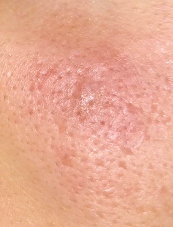 20180815_103737.thumb.jpg.ce7f8e40874b253921a9b85c00a7c783.jpg