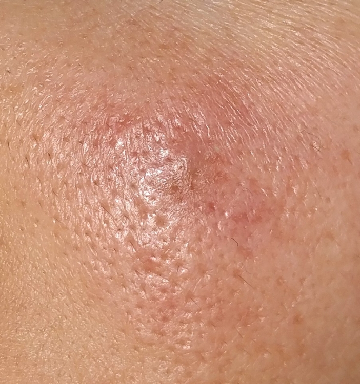 20180815_110353.thumb.jpg.95ac71d2651e01a5942a68dd2353258f.jpg