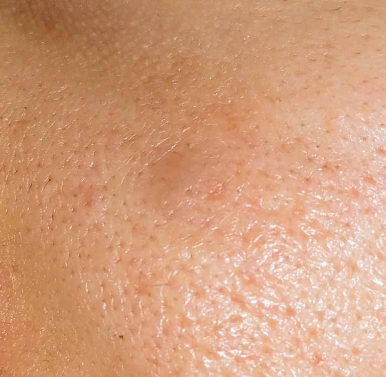 20180817_113919.thumb.jpg.ec9a8070d63d140382bf50fe9c8811b5.jpg