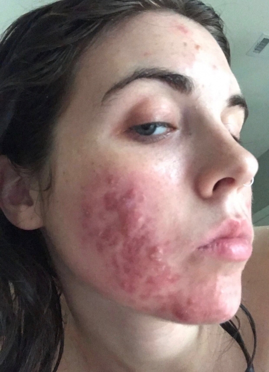 skinupdate1.jpeg