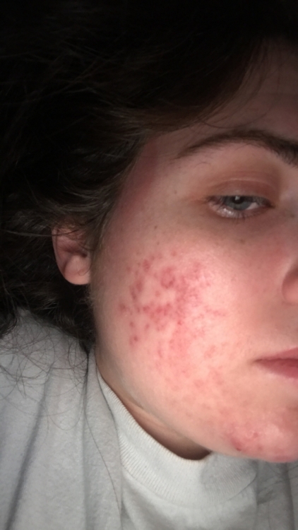 skinupdate3.JPG