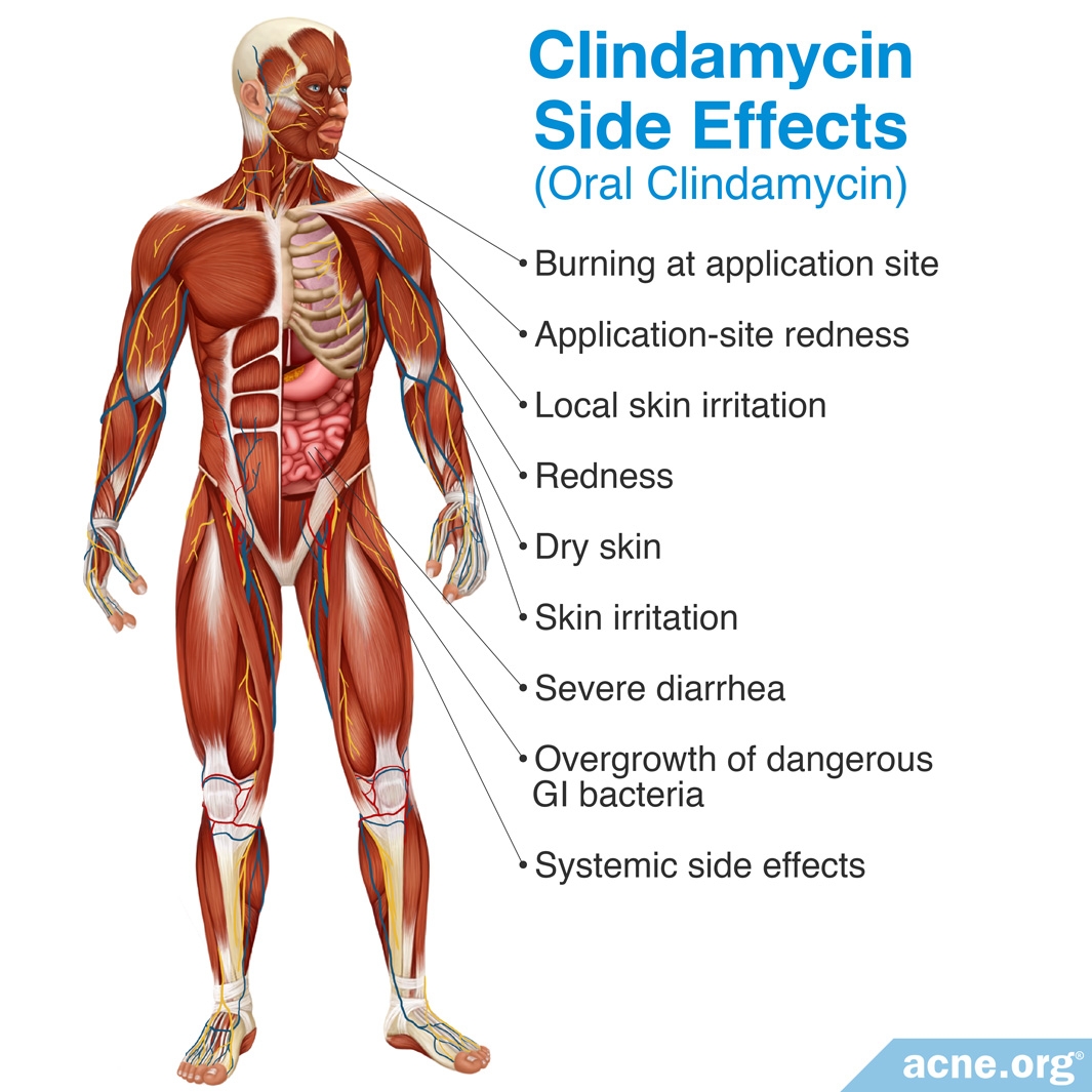 The Side Effects Of Antibiotics Acne Org