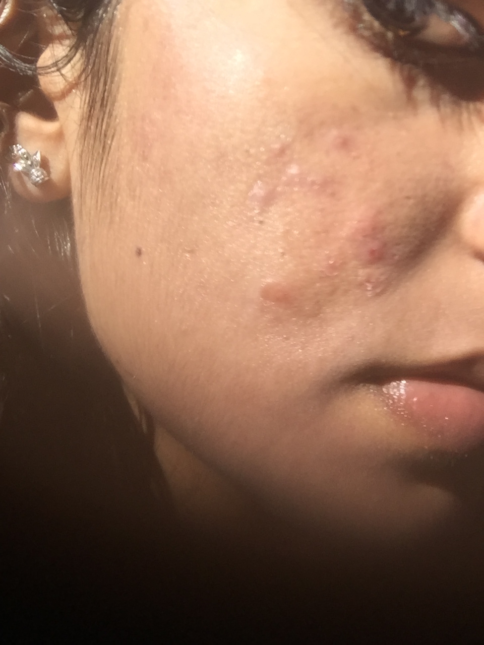 korean serum for combination skin