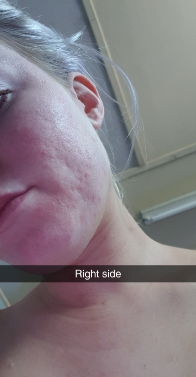 Snapchat-152154571.thumb.jpg.1af4b17e7f7d555ffadd5491410998f0.jpg