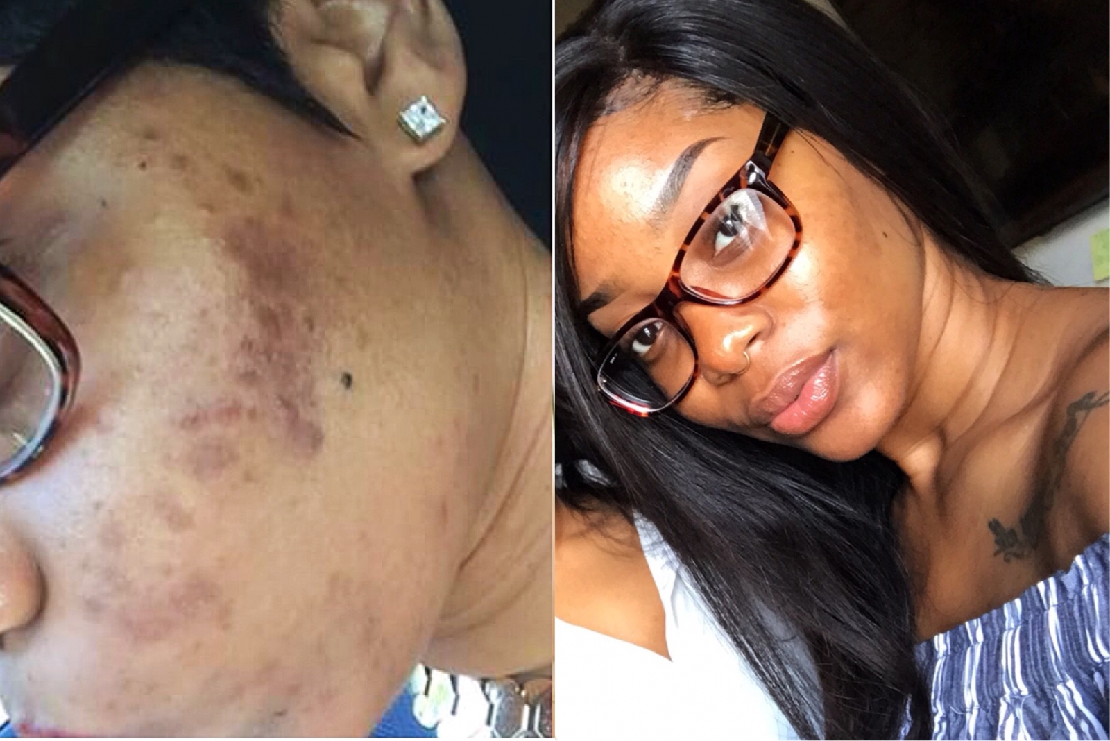 Before & After