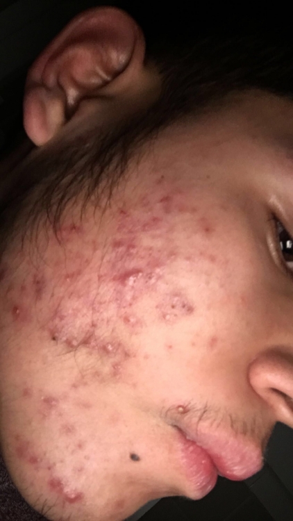 E21776C5-0AA6-448F-93F1-5C77AA50E32E.thumb.jpeg.64483528e2fb3aa27caa2cd42a7cd37f.jpeg