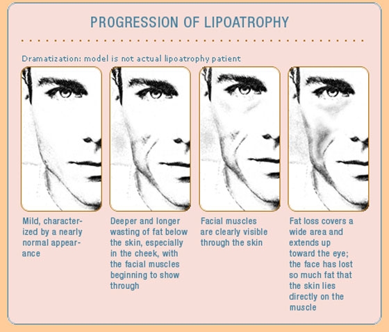Sculptrafatlossdownload.jpg