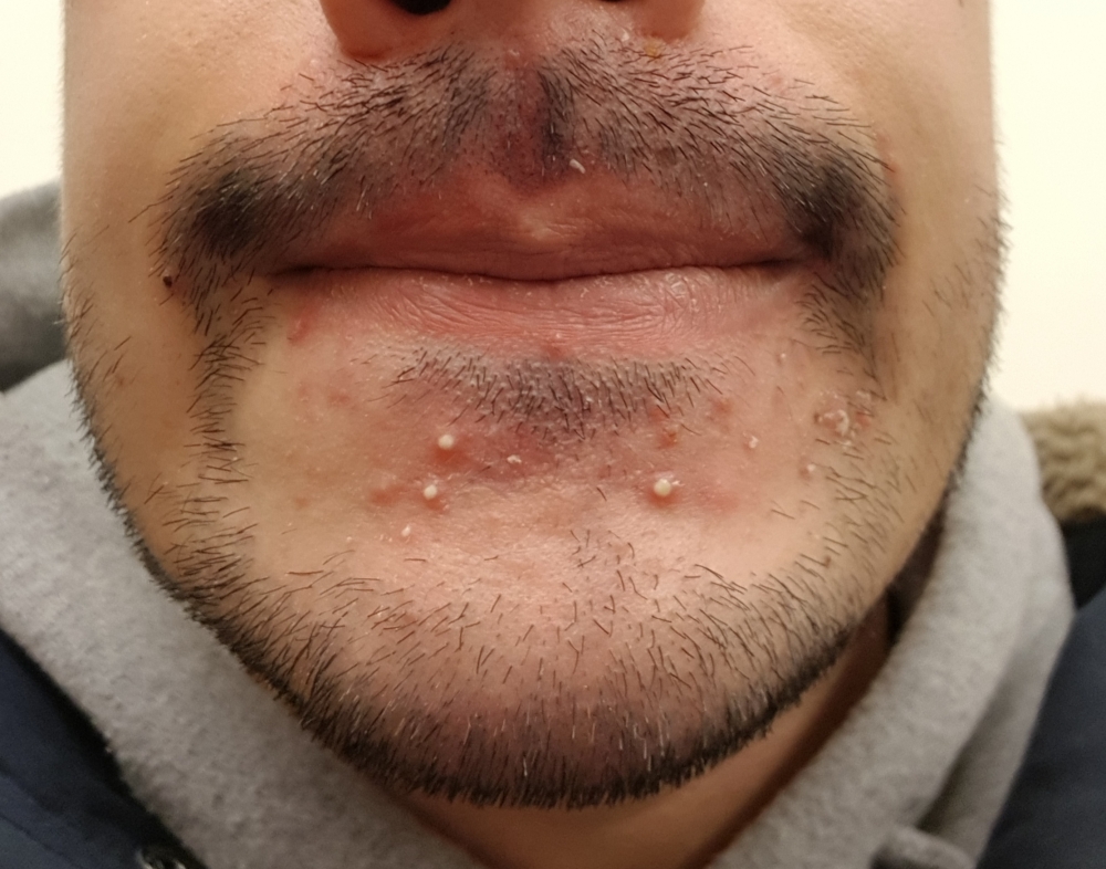 20181207_155443.jpg