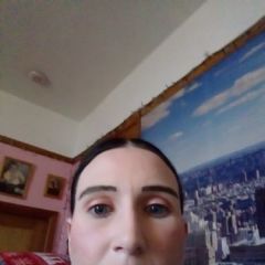Acne scar princess