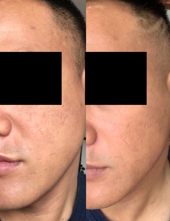 before_after_jan_14_01.thumb.png.0d78c2a0710f7090e93d8b680d1f578c.png