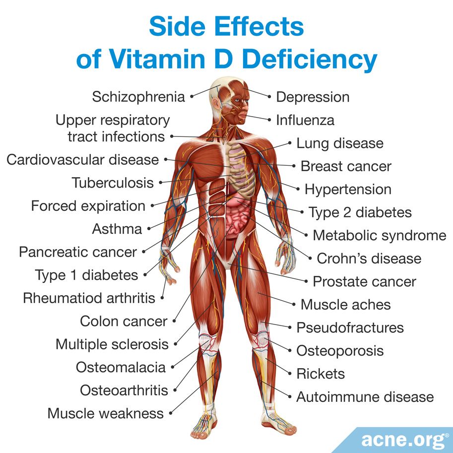 How Can You Get The Right Amount Of Vitamin D Acne