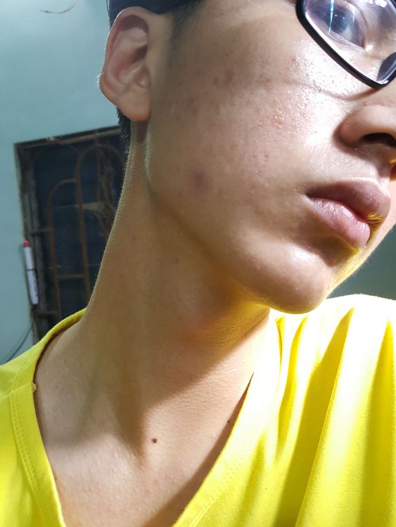 20190224_082210.jpg