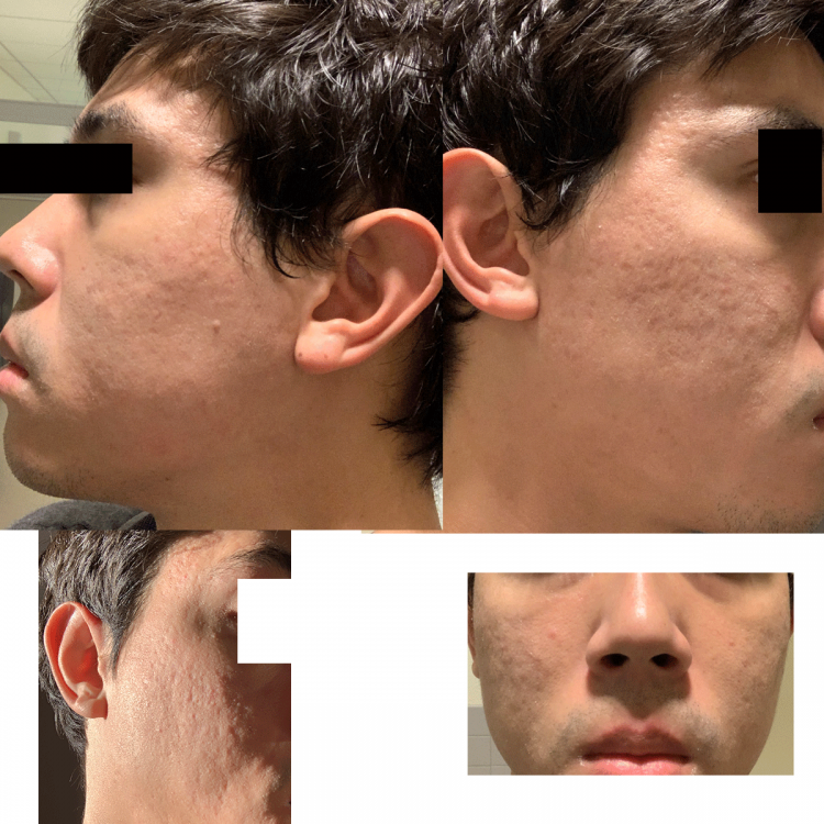 progress022519.thumb.png.bd357c9eb2194aa22cac35af2edfc787.png