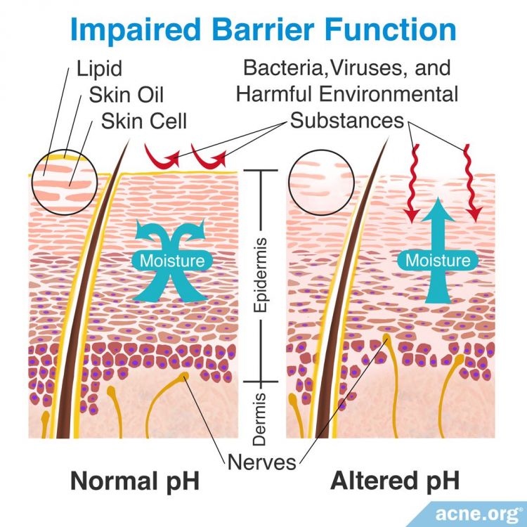 What Is the pH of Human Skin? - Acne.org