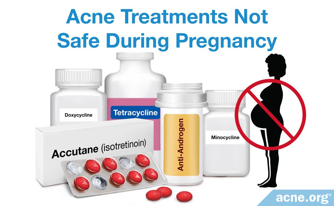 Alternative Treatment Options for Acne During Pregnancy - Acne.org