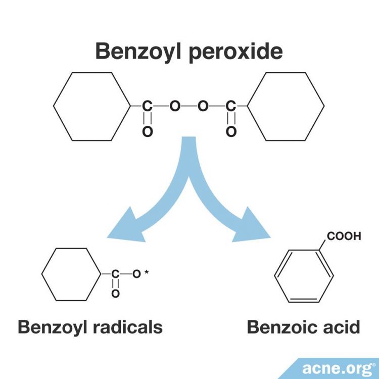 How Does Benzoyl Peroxide Work in the Skin?