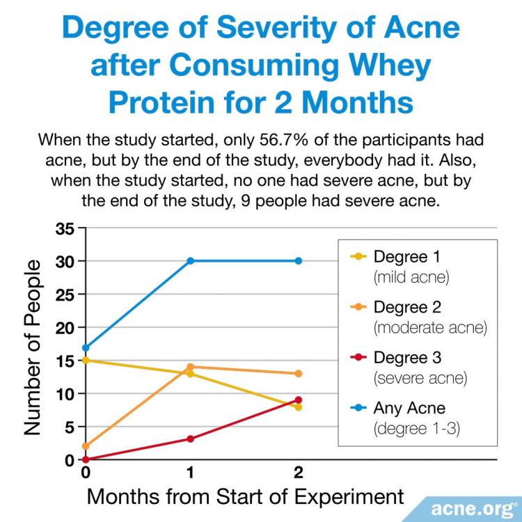 Can Protein Shakes Cause Acne?