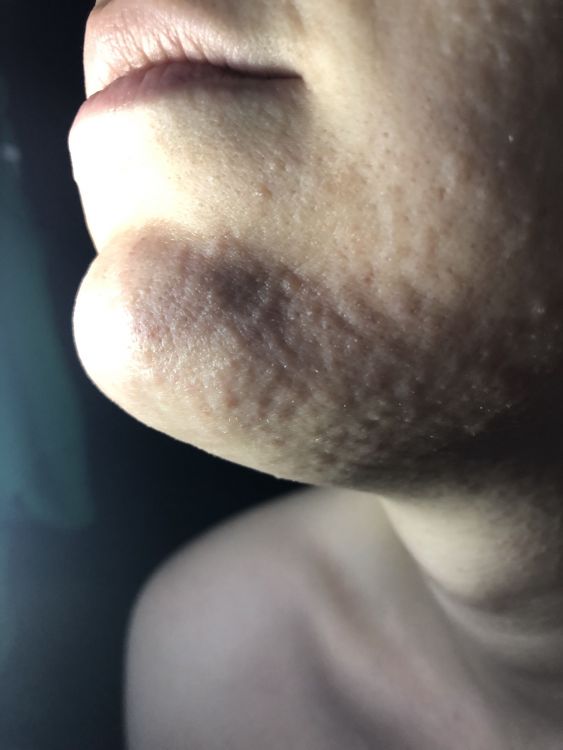 7EA73099-8EAB-4A76-A62F-0C8C565ACAF1.jpeg