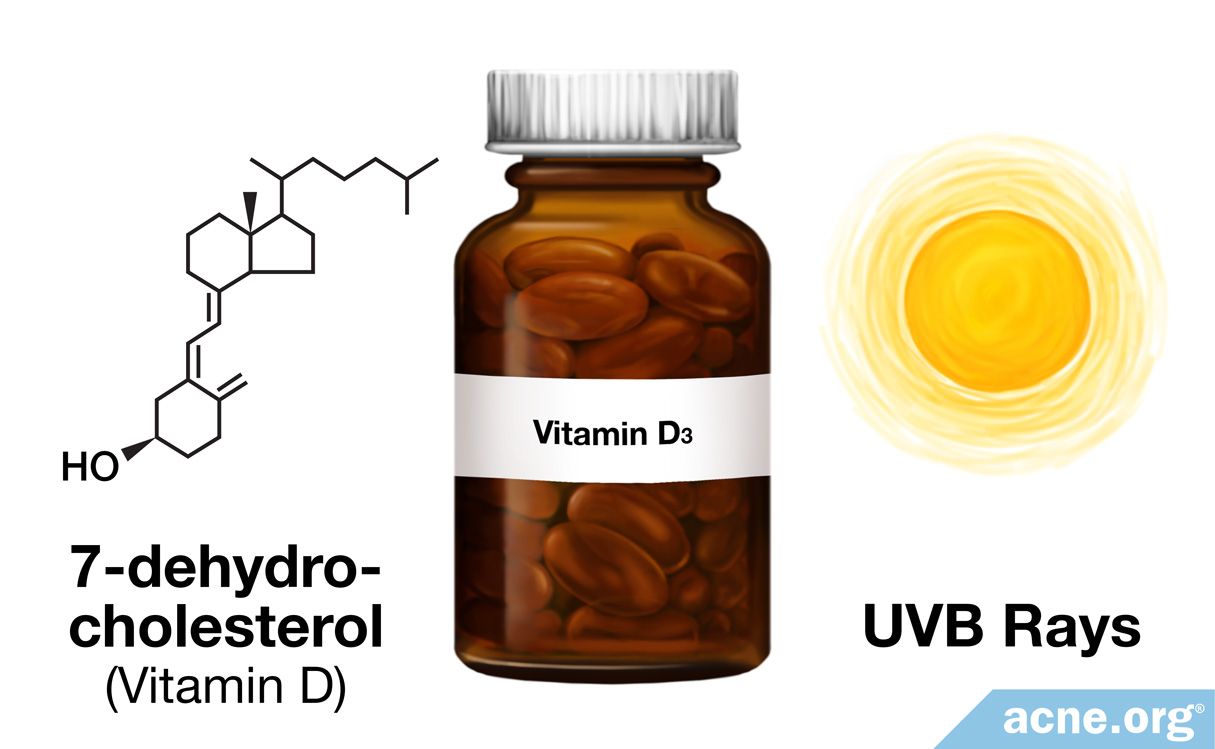 Does Vitamin D Help Treat Acne? - Acne.org