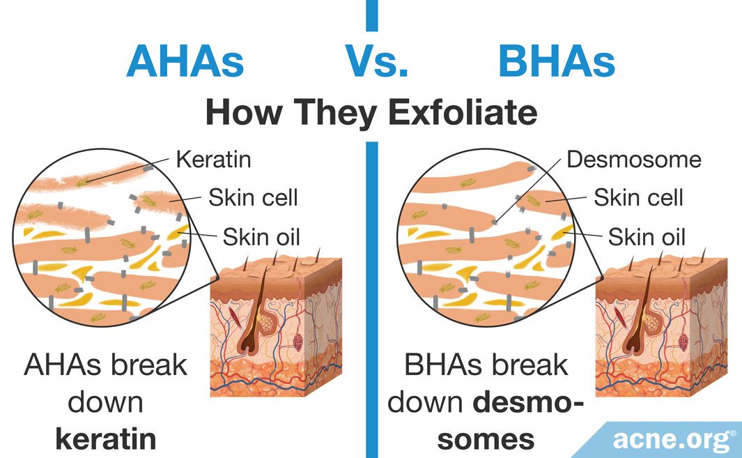Alpha Hydroxy Acids (AHAs) vs. Beta Hydroxy Acids (BHAs)