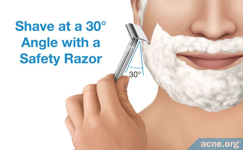 Choosing a Razor for Acneprone Skin