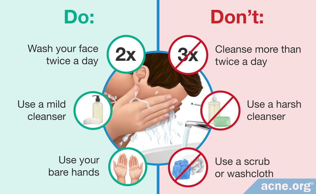 Does Washing the Skin Help or Hurt Acne?